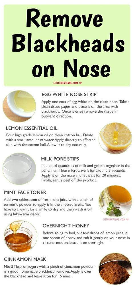 Remove blackheads Smooth Skin Tips, Dry Skin Home Remedies, Foods For Skin, To Remove Pimples, Skin Home Remedies, Reduce Oily Skin, How To Remove Blackheads, Remedies For Acne, Remove Pimples