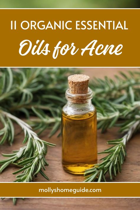 Essential Oils For Pimples, How To Use Frankincense Essential Oil, Best Essential Oils For Skin, Essential Oils For Acne, Acne Skin Care Products, Oils For Acne, Juniper Berry Essential Oil, Brightening Skincare, Natural Acne Remedies