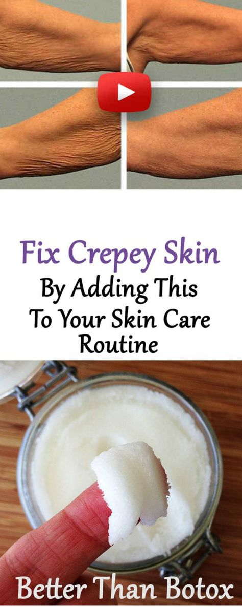 Weird Trick To Get Rid Of Crepey Skin Without Surgery Tighten Stomach, Skin Firming Lotion, Crepe Skin, Creepy Skin, Saggy Neck, Skin Tightening Stomach, Skin Tightening Cream, Firming Lotion, Tighten Loose Skin