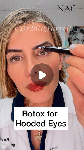 Botox Results, Botox Training, Botox Brow Lift, Esthetician Marketing, Facial Aesthetics, Brow Lift, Hooded Eyes, Lip Fillers, Med Spa