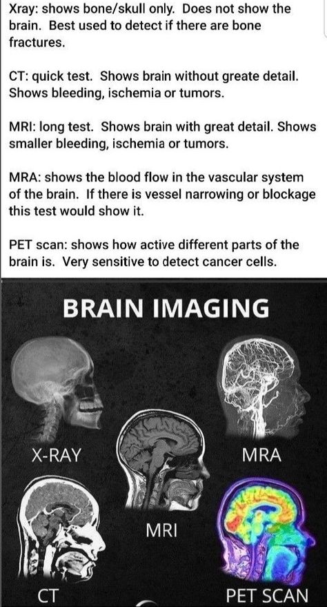 Brain Images, The Brain, Brain