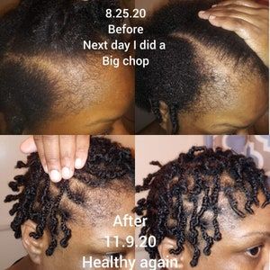 Hair Growth Cream, All Natural Hair Products, Hair Moisturizer, Dunner Wordend Haar, Shea Butter Hair, Edges Hair, Bald Spot, Bald Hair, Hair Growth Serum