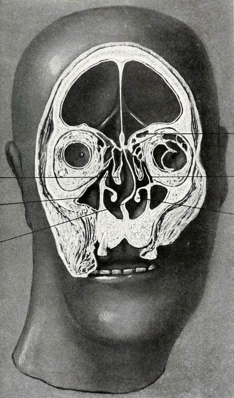 Structural anatomy of the human head. Successive frontal slices of adult male, brain removed - 3/7. Studies in the Anatomy and Surgery of the Nose and Ear. Adam E. Smith, 1918. Human Head, Vintage Medical, Anatomy Drawing, Arte Inspo, Scientific Illustration, Medical Illustration, Ap Art, Anatomy Reference, Anatomy Art