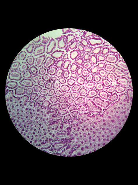 Simple epithelial cell of kidney. Tubule under microscope , #Affiliate, #cell, #epithelial, #Simple, #microscope, #Tubule #ad Microscopic Cells Biology Art, Cell Microscope Art, Cells Through Microscope, Human Cells Under Microscope, Human Cells Microscope, Cells Under Microscope Art, Cells Aesthetic Biology, Under The Microscope Art, Skin Cells Microscope