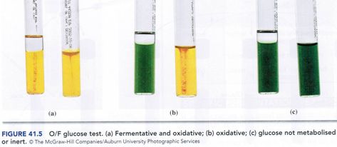 Medical Microbiology, Microbiology Study, Microbiology Lab, Gram Negative Bacteria, Medical Laboratory Scientist, Pseudomonas Aeruginosa, Liquid Paraffin, Lab Series, Glucose Test