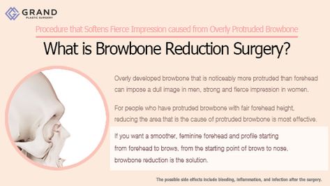 Browbone Reduction, Reduction Surgery, Free Consultation, Plastic Surgery, Surgery, Sleep Eye Mask, Personal Care, For Free, Tumblr