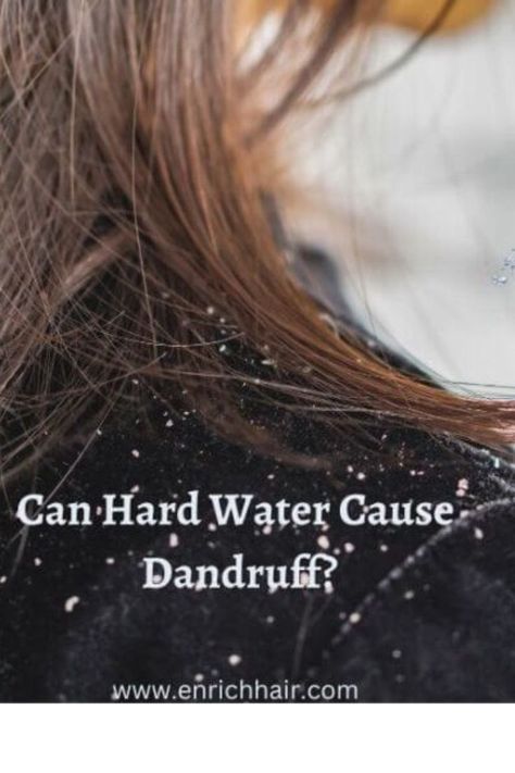 Can Hard Water Cause Dandruff? Hard Water Hair, Dandruff Causes, Water Can, Hard Water, Good Health, Dandruff, Water Filter, For Hair, Hair Hair