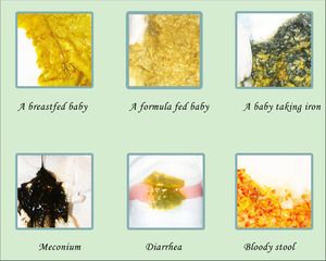 Formula Feeding Newborn, Baby Poop Guide, Breastfed Baby Poop, Baby Poop, 11 Month Old Baby, Formula Fed Babies, One Month Baby, Newborn Schedule, Baby Information