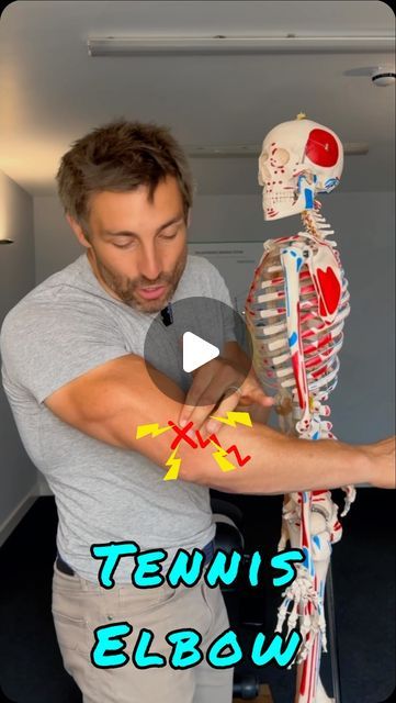 James Somerset Osteopath on Instagram: "Tennis elbow relief exercises. #tenniselbow #tenniselbowrelief" Tennis Elbow Relief Remedies, Tennis Elbow Relief Exercises, Shoulder Stretching Exercises, Tennis Elbow Relief, Shoulder Stretching, Tennis Elbow Exercises, Elbow Exercises, Shoulder Stretches, Tennis Elbow