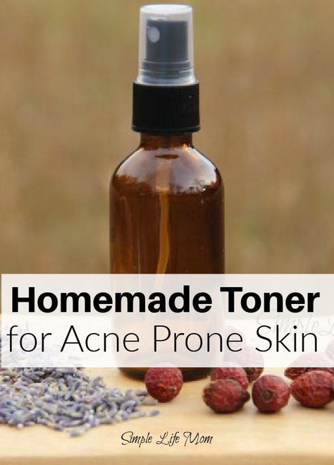 Unearth the secret to clear skin with Simple Life Mom's DIY Acne-Fighting Toner. Learn how to concoct a natural, cost-effective solution for acne-prone skin at home. Say goodbye to costly store-bought products, and embrace this simple, sustainable skincare regime. Toner For Acne Prone Skin, Homemade Toner, Different Types Of Acne, Acne Toner, Water Witch, Diy Acne, Natural Cleanser, Frankincense Essential Oil, Beauty Diy