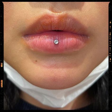 Piercings Inspiration Lips Percinings, Ashley Lip Piercing Jewelry, Lip Ring Ashley, Bottom Middle Lip Piercing, Ashley Piercing On Small Lips, Lip Dermal Piercing, Center Lip Piercing, Lips Piercing Aesthetic, Small Lip Piercing