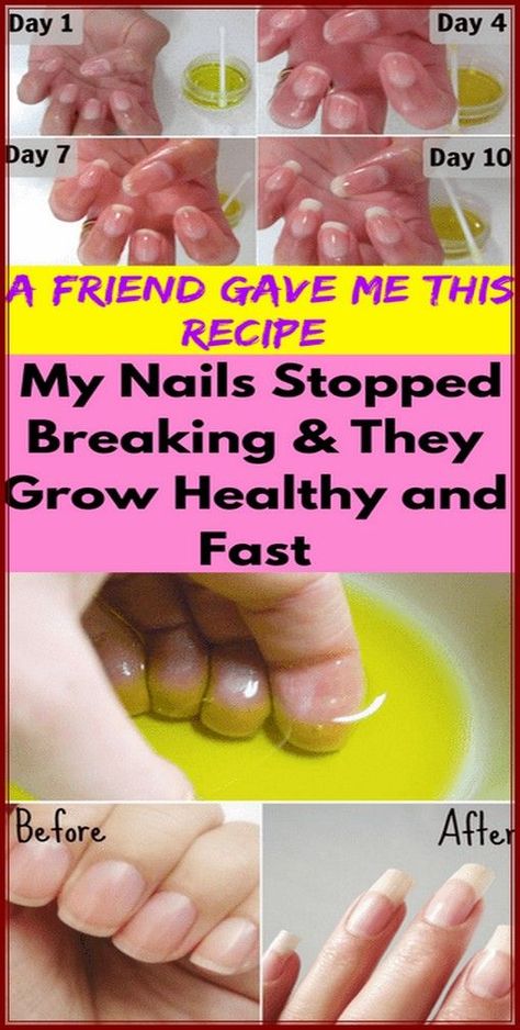 Face Hacks, 2016 Nails, Weak Nails, Transparent Nails, How To Grow Nails, Nail Growth, Strong Nails, Healthy Nails, Beauty Ideas