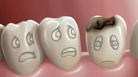 Home Remedies For Cavities, Remineralize Teeth, Tooth Infection, Heal Cavities, Dental Cavities, Tooth Pain, Tooth Sensitivity, Oil Pulling, Glow Skin