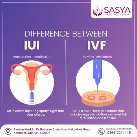 creative ads for fertility centre Or Nurse, Fertility Center, In Vitro Fertilization, Conceiving, Fertility