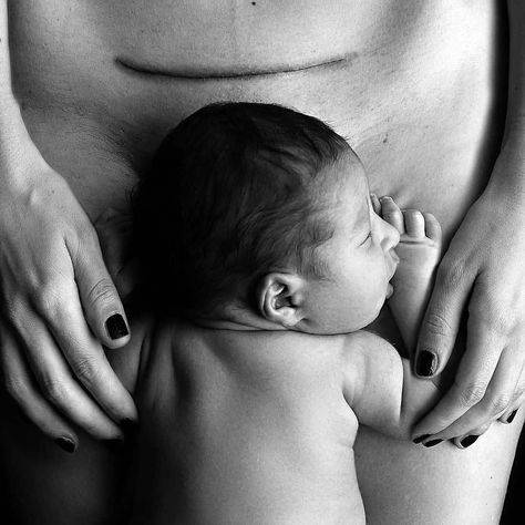 Simple is Beautiful on Instagram: “Photo by Yvonne C. Krystovsky, Germany #birth #baby #mother #nature #sleep #photography #simpleisbeautifulphotography #blackandwhite…” Sleep Photography, Simple Is Beautiful, C Section Scars, Birth Mother, Birth Photography, C Section, Newborn Shoot, Baby Birth, Instagram Photography