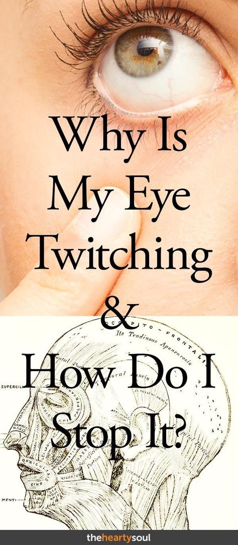 Sometimes your eye can twitch and you may not even notice. Stress and fatigue play as a large contributor to this. Here are 7 causes for eye twitches and possible relief remedies. #twitch, #eye, #stress, #fatigue Eye Twitch Remedy, Right Eye Twitching, Stop Eye Twitching, Eye Twitch, Nail Remedies, Eye Twitching, Blurry Vision, Neurological Disorders, Traditional Medicine