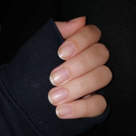 Healthy Nails Natural, Natural Nail Shapes, Short Natural Nails, Nail Strengthening, Split Nails, Bare Nails, Plain Nails, Nail Salon Design, Nail Envy