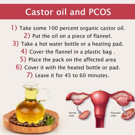 castor-oil-for-pgos Ovary Pain, Women Wellness, Caster Oil, Castor Oil Packs, Polycystic Ovarian Syndrome, Polycystic Ovaries, Endocrine System, Naturopathy, Hormone Health