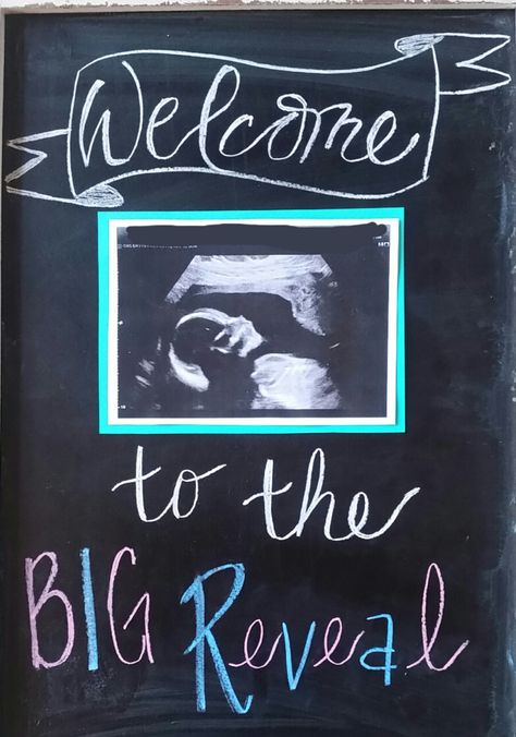 Gender Reveal Chalkboard Sign, Party Chalkboard Sign, Gender Reveal Chalkboard, Gender Signs, Party Chalkboard, Simple Gender Reveal, Creative Gender Reveals, Gender Reveal Baby Shower Themes, Gender Reveal Signs