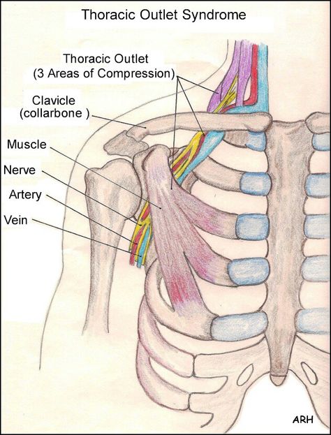 Pic Thoracic Outlet, Neck And Shoulder Exercises, Massage Pictures, Repetitive Strain Injury, Spinal Nerve, Massage Business, Spine Health, Muscle Anatomy, Massage Benefits