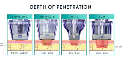 Morpheus 8, Rf Microneedling, Post Inflammatory Hyperpigmentation, Acne Scarring, Facial Contouring, Firmer Skin, Skin Resurfacing, Beauty Care Routine, Skin Tissue