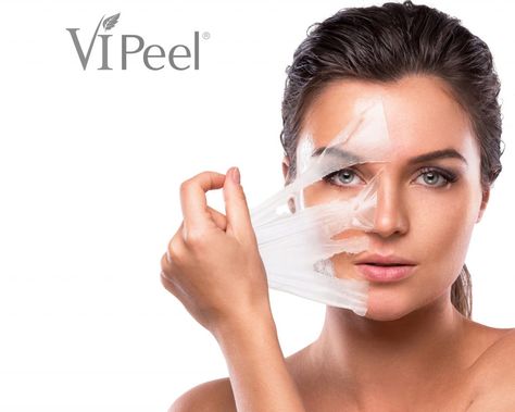 Chemical Peel Fort Myers | Facial Peel Naples Best Chemical Peel, Lemon On Face, Baking Soda For Hair, Peeling Facial, Blackhead Remedies, Honey Face Mask, Arm Workouts, Honey Face, Facial Peel