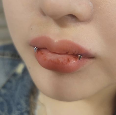 Angel Bites Piercing, Angel Bites, Upper Lip Piercing, Vertical Labret Piercing, Snake Bite Piercing, Mouth Piercings, Vertical Labret, Nail Piercing, Face Piercings