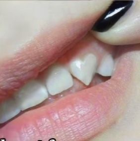 Heart Fangs, Teeth Aesthetic, Teeth Shape, Vampire Teeth, Beautiful Tiaras, Body Mods, Art Reference Photos, Aesthetic Fashion, Aesthetic Pictures