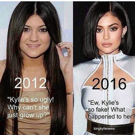 Kylie Jenner meme Kylie Jenner Funny, Keke Palmer Instagram, Kylie Jenner Transformation, Kylie Jenner Plastic Surgery, Botox Lips, Kylie Jenner Look, Celebrity Plastic Surgery, Celebrities Before And After, Kylie Jenner Style