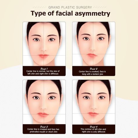 Here are different types of asymmetrical faces and the suitable correction methods for each typeFor free consultationTel( 8270-7119-1580 Mobile( 8210-7156-6546(WhatsappLineKakaotalkViberiMessageEmailgrandps.en@gmail.com Facebookfacebook.com/grandplasticsurgery Webstieeng.grandsurgery.com Pinterests://www.pinterest.co.kr/grandps_engTumblr://grandsurgery.tumblr.comInstagramgrandps_eng Exercise For Assymetrical Face, Hairstyles For Asymmetrical Faces, Makeup For Asymmetrical Face, Makeup For Assymetrical Face, Asymmetrical Face Aesthetic, Assymetrical Face Aesthetic, Assymetrical Face Exercise, Unsymmetrical Faces, Types Of Smiles