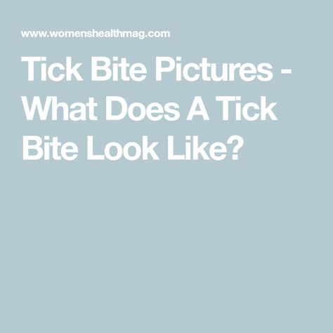 Tick Bite Pictures - What Does A Tick Bite Look Like? Tick Bites Pictures, Tick Bite Symptoms, Types Of Bug Bites, Fever Rash, Bug Bite, Deer Ticks, Types Of Bugs, Tick Bite, Weekend Camping Trip