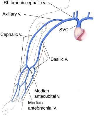 Picc Line Vs Midline, Picc Nurse, Nursing Cardiac, Nursing Facts, Diagnostic Medical Sonography Student, Human Body Muscles, Phlebotomy Study, Radiology Nursing, Picc Line