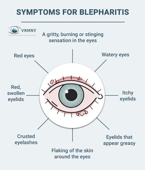 Itchy Eyelids, Optician Training, Eye Health Facts, Optometry Education, Eye Disorders, How To Help Nausea, Eye Facts, Irritated Eye, Biology Facts