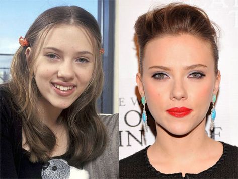 alllmost makes me want this too, I've got a pre -scar-jo nose-job nose ;) Scarlett Johansson, Before and After - Beauty Editor Ethnic Rhinoplasty, Rhinoplasty Nose Jobs, Hair Implants, Face Surgery, Rhinoplasty Before And After, Wide Nose, Perfect Nose, Celebrity Plastic Surgery, Celebrities Before And After