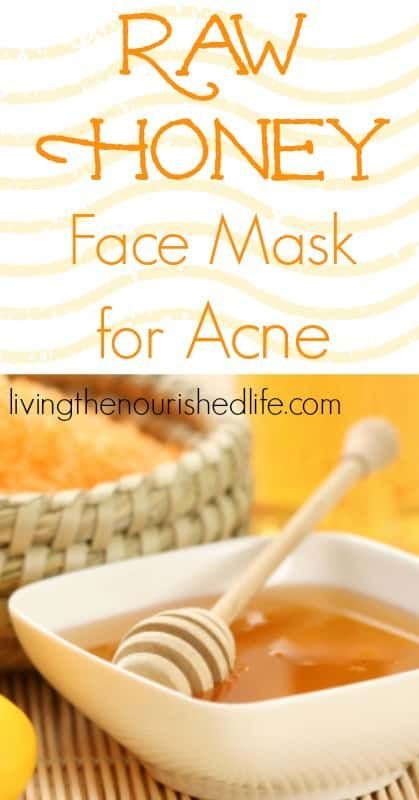 Try this Raw Honey Face Mask for Acne Raw Honey Face Mask, Homemade Face Mask For Acne, Face Mask For Acne, Mask For Acne, Honey Face Mask, Honey Mask, Homemade Face Mask, Facial Treatments, Honey Face