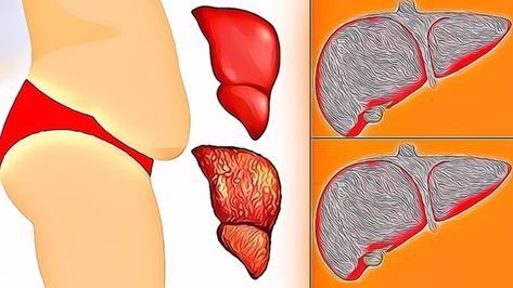 A month before a stroke, your body will send you these warning signs Nighttime Leg Cramps, Bad Circulation, Leg Cramps At Night, All Body Systems, Chronic Fatigue Symptoms, The Digestive System, Clogged Arteries, Lemon Water Benefits, Healthy Lifestyle Quotes