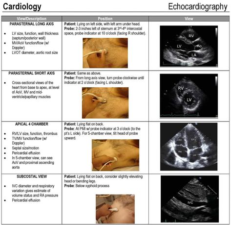 Sonography Notes Ultrasound, Diagnostic Medical Sonography Student Notes, Kids Pirate Crafts, Cardio Sonography, Medical Sonography Student, Sonography Student Study, Sonography Notes, Ultrasound Technician Student, Echo Ultrasound