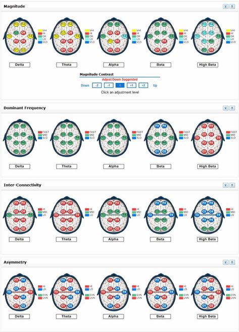 brain-map Psychotropic Medications, Brain Anatomy And Function, Brain Mapping, Brain Anatomy, Brain Games, Brain Training, Neurology, Neuroscience, Map Design