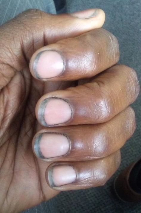 Remove Acrylics, Remove Acrylic Nails, Acrylic Nails At Home, Instagram Profile Picture Ideas, Nails At Home, Island Girl, Fashion Hacks Clothes, Cute Nail Designs, Funky Nails