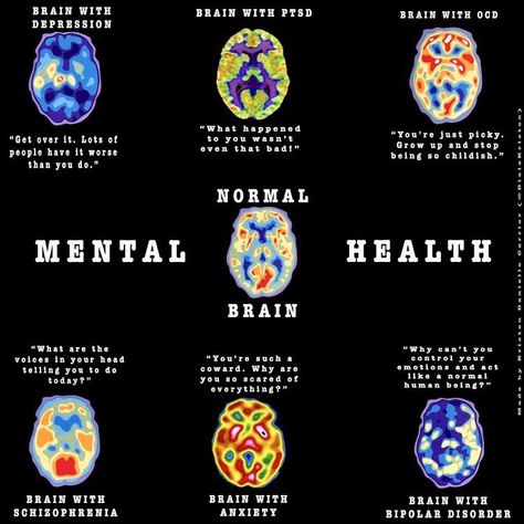 Brain Facts, Mental Health Facts, Medical Knowledge, Mental Disorders, Post Traumatic, Psychology Facts, Mental And Emotional Health, Health Conditions, Neuroscience