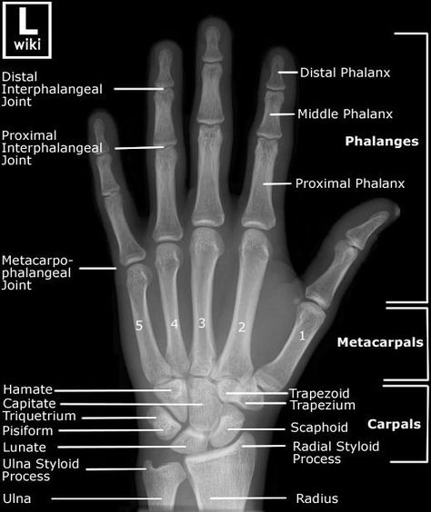 Embedded Radiography Student, Radiology Schools, Medical Radiography, Radiology Student, Radiology Technician, Radiology Imaging, Medical School Studying, Medical Imaging, Medical Anatomy