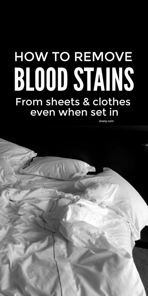 Blood Out Of Clothes, Remove Blood Stains, Get Blood Stains Out, Natural Stain Remover, Baking Soda Benefits, Deep Cleaning Hacks, Old Blood, Delicate Clothes, Grease Stains