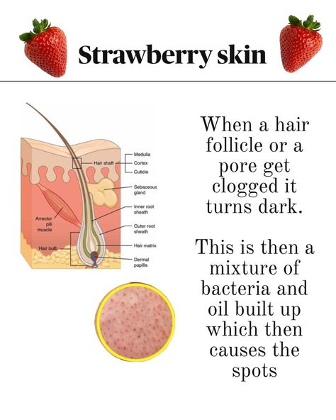 Yesterday while taking to you There was a bunch of questions regarding this so this is a post for you to Save❣️ Also, dark armpits, gua sha routine, chest acne and Chemical peels Are coming I always read all of your messages and then make a post about it❤️ #skin #strawberrylegs #shaving #exfoliating #laserhairremoval #smoothskin Gua Sha Routine, Chest Acne, Matrix Hair, Strawberry Legs, Dark Armpits, Chemical Peels, Chemical Peel, Gua Sha, Laser Hair Removal