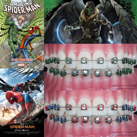 Spiderman Homecoming braces colors   #Spiderman #spidermanhomecoming #PeterParker #TomHolland #CaptainAmerica #ChrisEvans #robertdowneyjr #TonyStark #IronMan #vulture #Marvel #marvelcinematicuniverse #MCU #marvelcomics #braces #colors #color #dental #dentist #dentistry #orthodontics #orthodontist #marisatomei Vulture Marvel, Spiderman Home, Braces Smile, Lingual Braces, Cute Braces Colors, Cute Braces, Brace Face, Braces Colors, Dental Braces