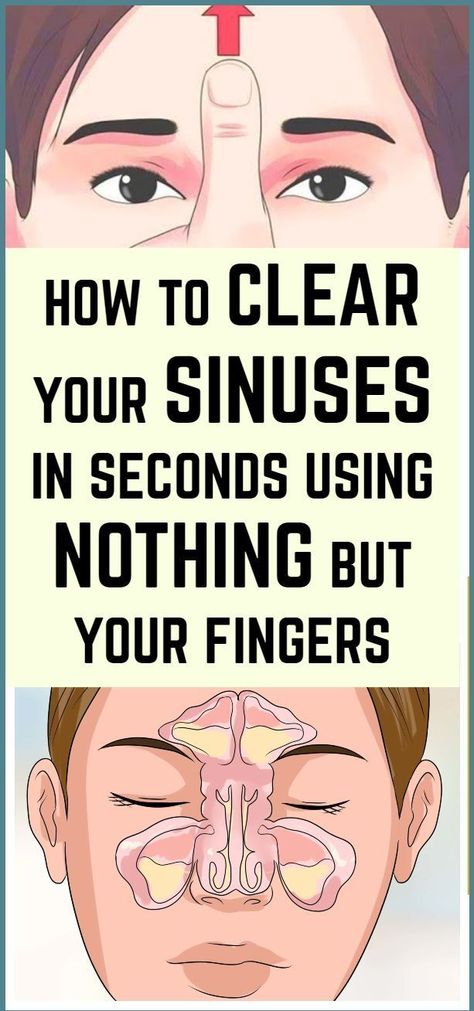 HOW TO CLEAR YOUR SINUSES IN SECONDS USING NOTHING BUT YOUR FINGERS #HealthyHealthTips #PureGreenCoffeeBeansForWeightLoss Natural Sinus Remedies, Clear Sinuses, Clear Your Sinuses, Summer Health Tips, Sinus Remedies, How To Clear Sinuses, Healthy Life Tips, Sleeping Well, Summer Health