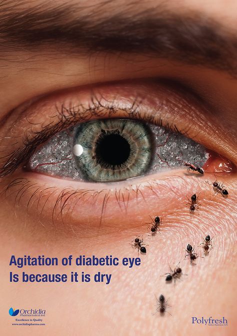 Interesting to see this eye drop ad- Rohto inspo Eye Poster Design, Eye Creative Ads, Eye Hospital Creative Ads, Eye Advertising, Advertising Campaign Design, Healthcare Ads, Healthcare Advertising, Eye Poster, Health Ads