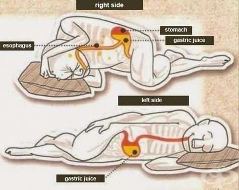 What Happens to Your Body When You Sleep on Your Left Side Sleep On Left Side, Punkty Spustowe, Gastric Juice, Benefits Of Sleep, Stomach Problems, Natural Antibiotics, Sleeping Positions, Acid Reflux, Pranayama