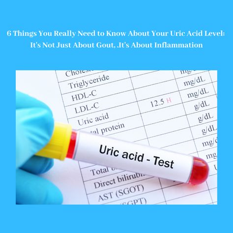 Uric Acid Remedy, Uric Acid Symptoms, Uric Acid Food, Uric Acid Diet, Purine Diet, Uric Acid Crystals, Uric Acid Levels, C Reactive Protein, Increase Blood Pressure