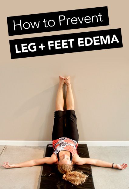 How do we define edema? Well, it’s just a fancy word for swelling that takes place in the body. This swelling can occur for different reasons ... Swelling Remedies, Edema Causes, Grapefruit Benefits, Water Retention Remedies, Sore Legs, Swollen Knee, Swollen Ankles, Swollen Legs, Compression Stockings