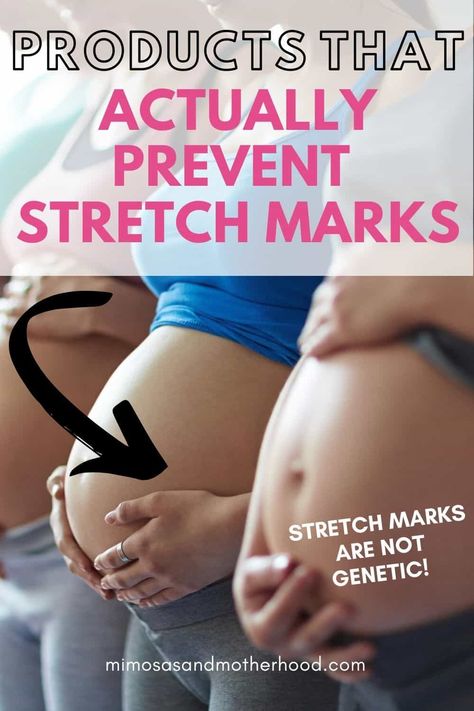 Natural Labor, Acne Prone Skin Care, Tips For Oily Skin, Oily Skin Acne, Stretch Mark Removal, Stretch Mark Cream, Easy Stretches, Saggy Skin, Dry Skin Care